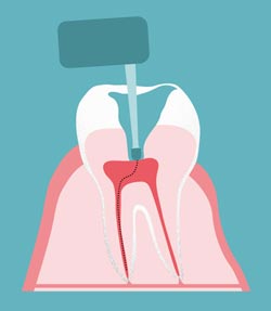 � proDente e.V./piabublies.de