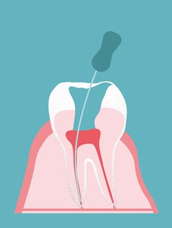 � proDente e.V./piabublies.de