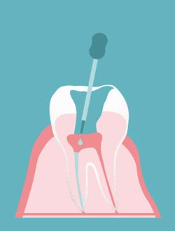 � proDente e.V./piabublies.de