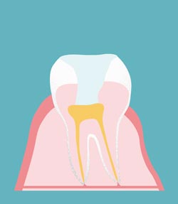 � proDente e.V./piabublies.de