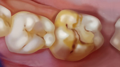 � proDente e.V./julistrationen.de