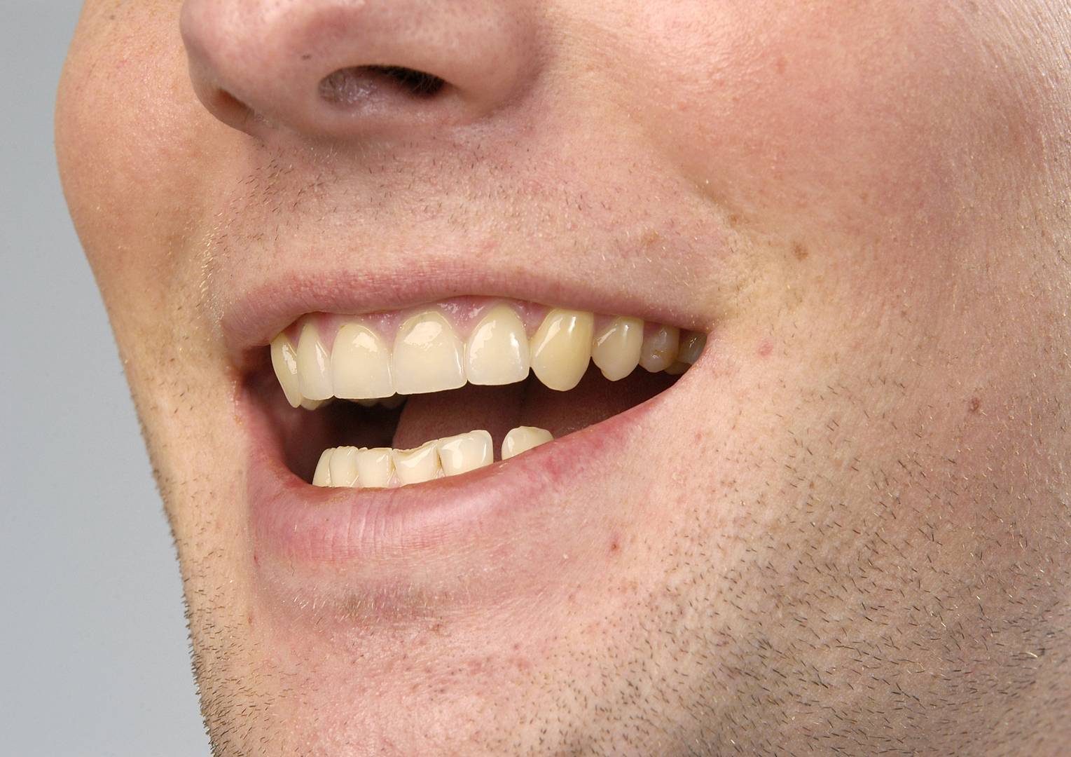 � proDente e.V./Kurt Steinhausen