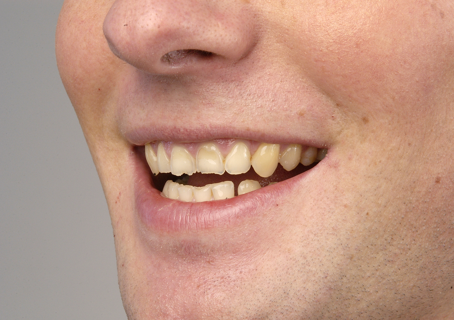 � proDente e.V./Kurt Steinhausen